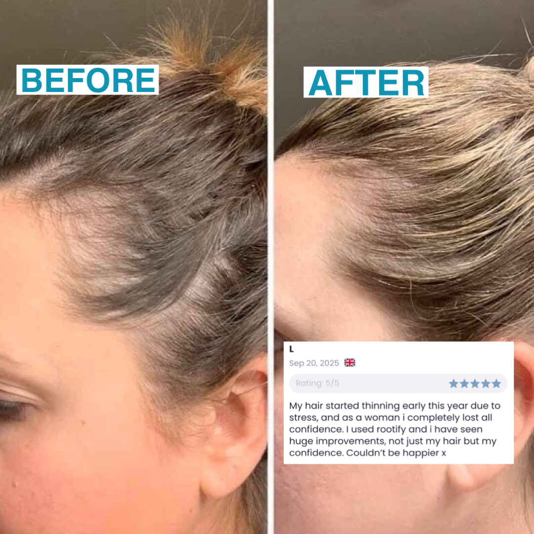 Rootify - Hair Growth Serum