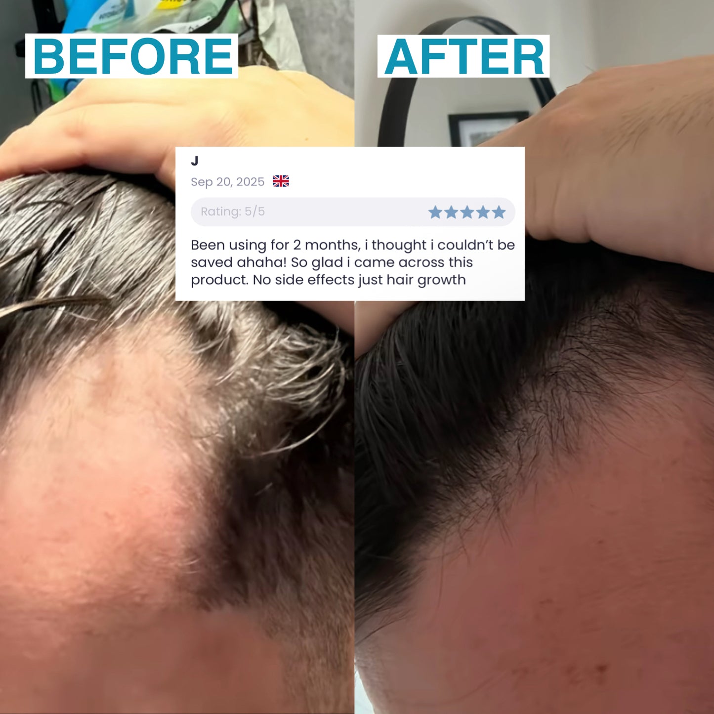 Rootify - Hair Growth Serum