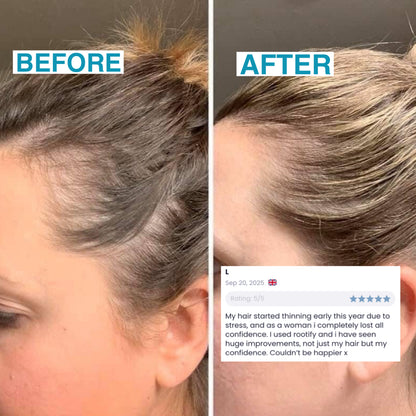 Rootify - Hair Growth Serum