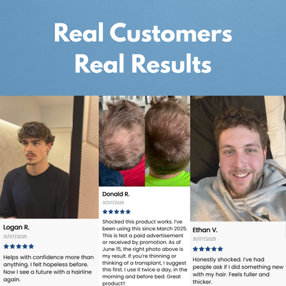 Rootify - Hair Growth Serum